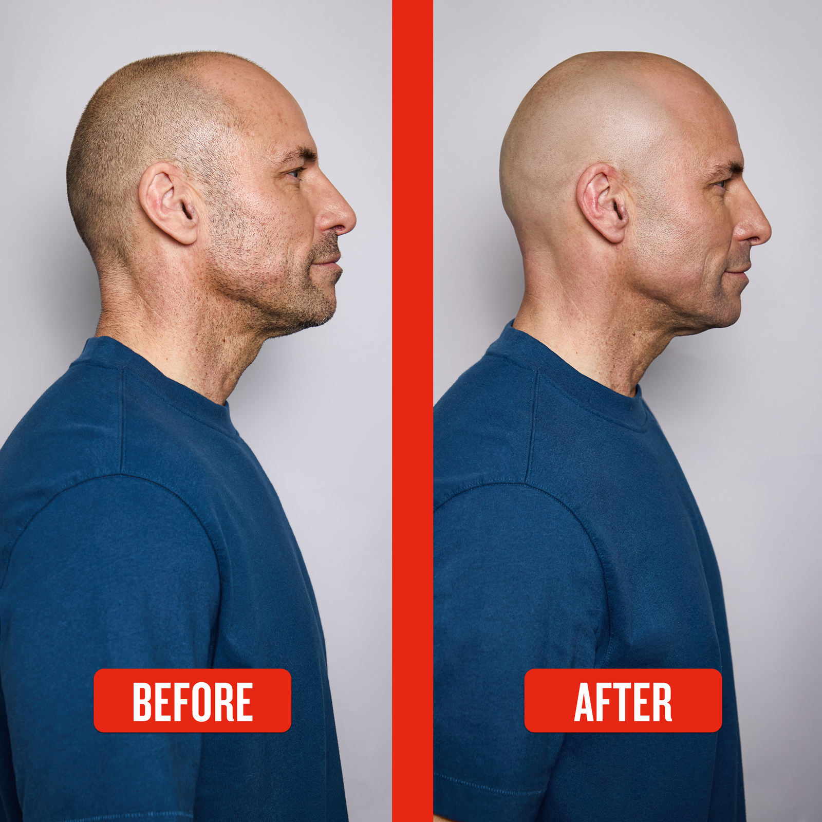 Balder Head & Face Shaver - Image 7