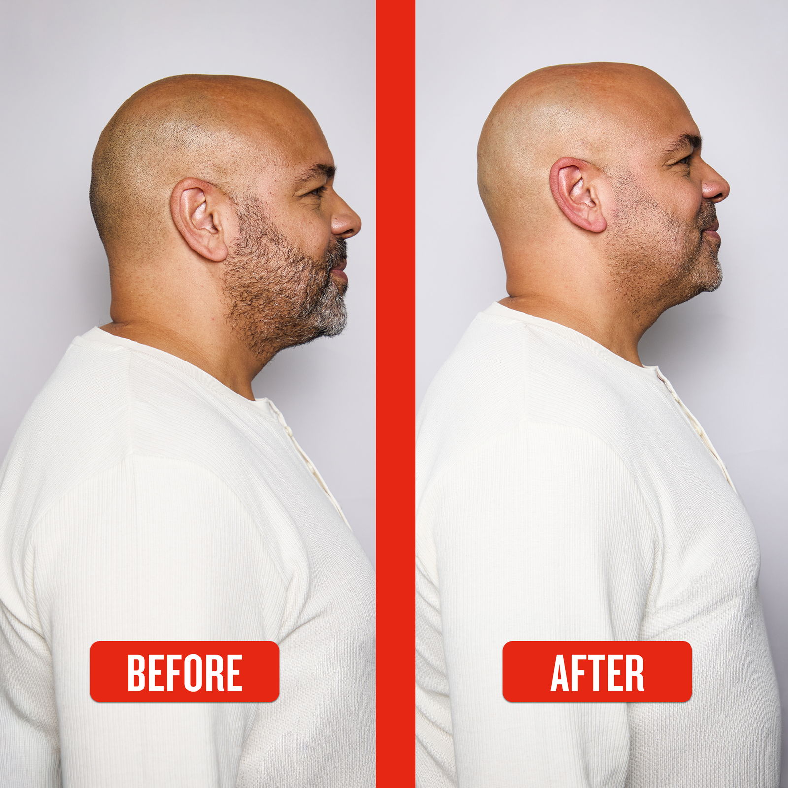 Balder Head & Beard Shaver ?C 5 Flex Blades - Image 9